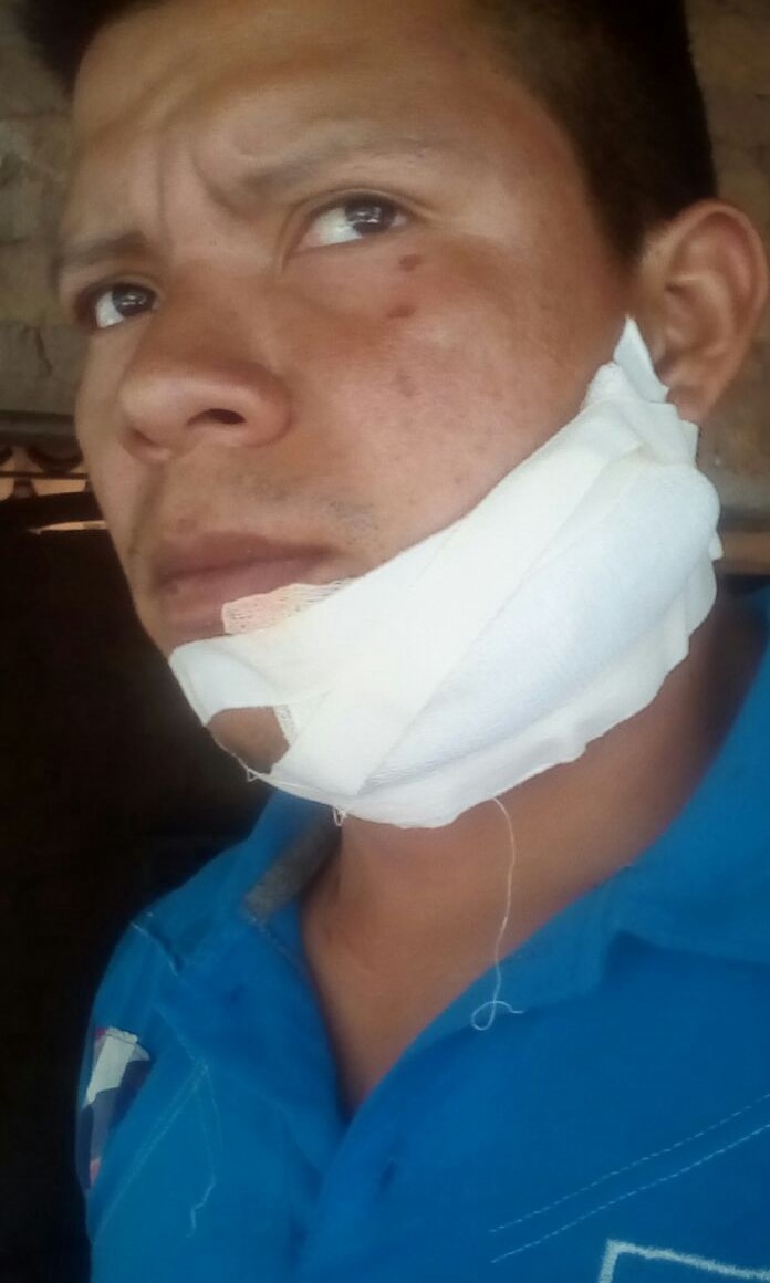 Misael Sánchez, semanas después de que un hombre encapuchado le cortara su cama con un machete después de una reunión del sindicato cerca de Choluteca, Honduras. 